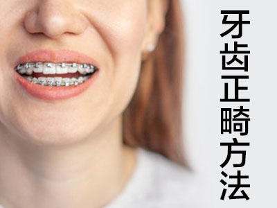 龅牙牙齿矫正 天津龅牙缺门牙牙齿矫正过程