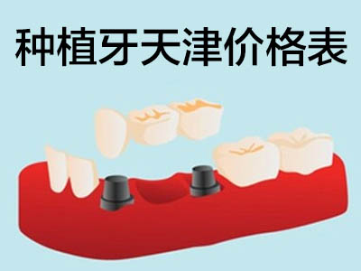 科普种植牙价格表 天津3d打印牙齿需要多少钱