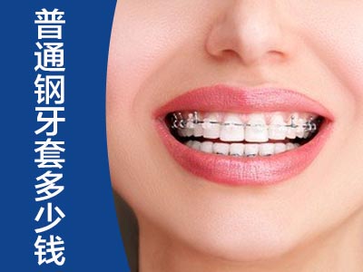 牙齿矫正价格表 天津牙齿正畸形矫正多少钱