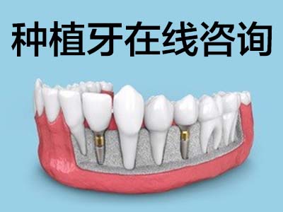 美国种植牙品牌及价格表  天津河东美国种植牙多少钱一颗?