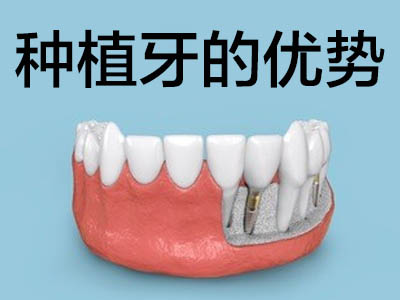 解答天津南开牙科医院种植牙一般多少钱一颗