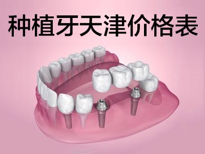 种植牙价格 天津南开种植牙德国进口材料多少钱一颗