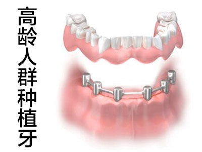 认知天津红桥烤瓷牙多少钱一颗价格表2022