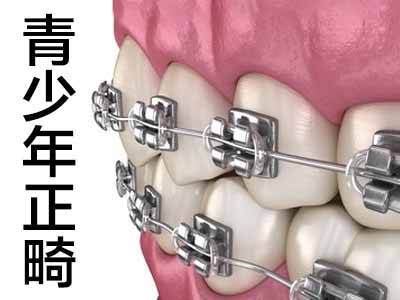 天津儿童换牙时牙齿畸形图片