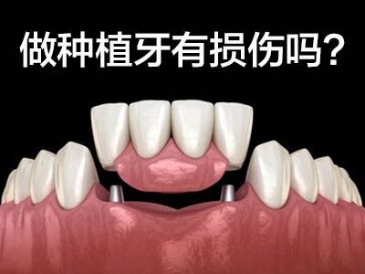 科普天津和平国产普通半口牙需要多少钱