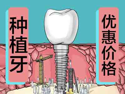 天津北辰种牙齿一般多少钱一颗