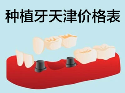 种植牙价格表 天津南开看牙医要多少钱