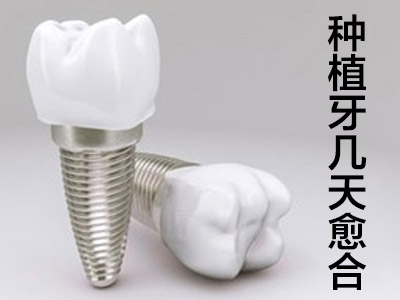 牙套价目表  天津医院种植牙一般多少钱一颗