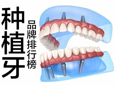 老年人种植牙价格 天津南开老年人满口种牙需要多少钱?