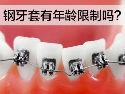 天津错颌畸形牙齿矫正方法 牙齿矫正过程