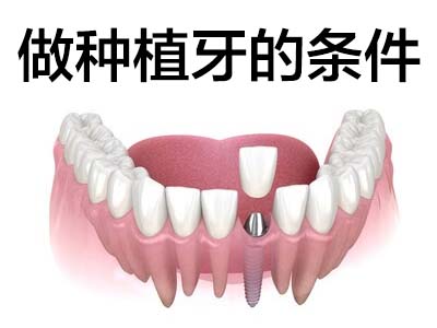 种植一颗牙价钱表  天津医院种植牙一般多少钱一颗