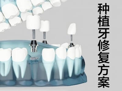 牙齿植骨手术费用  天津北辰口腔植骨手术要多少钱