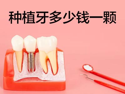 天津正规医院种植一颗牙大概多少钱