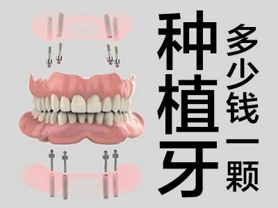 天津种植全口牙的材料及价格 种植牙多少钱