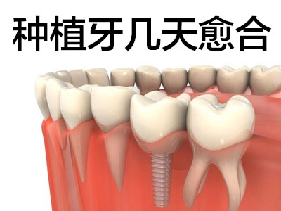 认知天津拔上牙到种植牙过程需要多长时间