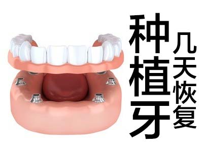 天津钛合金种植牙能用多久