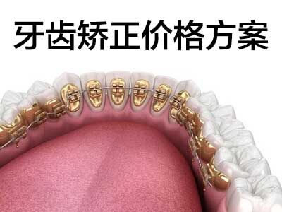 天津正规医院牙齿隐形矫正一般多少钱