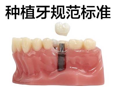 天津做人工牙种植需要多少钱