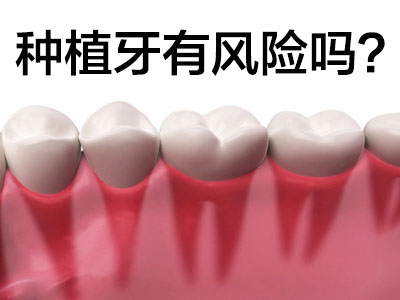 天津大牙种植牙一颗大概多少钱