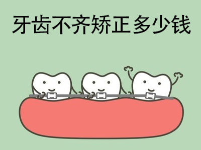 天津一般成人牙齿矫正要多少费用