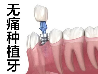 科普天津65岁老人种植半口牙需要多少钱