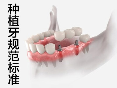 解答天津一颗人工种植牙需要多少钱