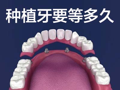 认知天津儿童种植一颗牙需要多少钱