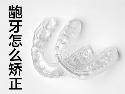 天津成人龅牙37周岁矫正牙齿多少钱