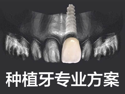 天津国内种植一颗牙大概多少钱 全新价格表
