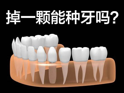 天津骨粉手术后多长时间可以种植牙