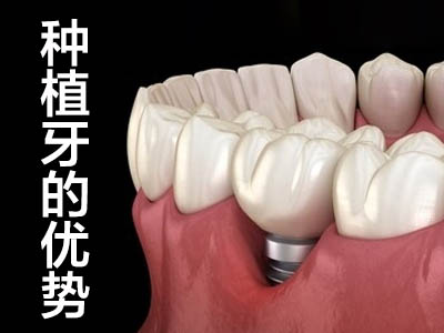 天津25岁种植牙可以用多久