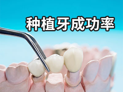 种植牙价格一览表  天津老年人种植牙需要多少钱
