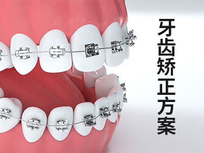 成人矫正牙齿要多少时间  天津成人矫正牙齿一般多长时间