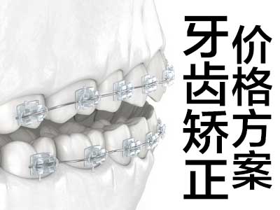 天津隐形牙套矫正牙齿的过程步骤