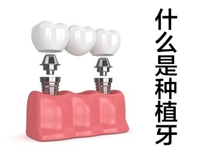 详细的天津韩国奥齿泰种植牙的价格