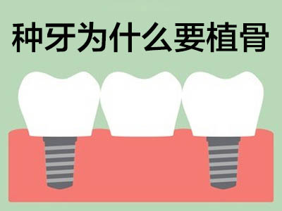 解答天津即刻种植牙半口价格是多少