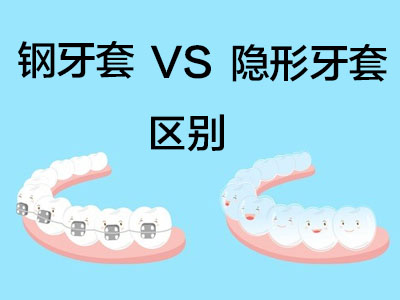 牙齿矫正价格 天津牙齿隐形矫正要多少钱