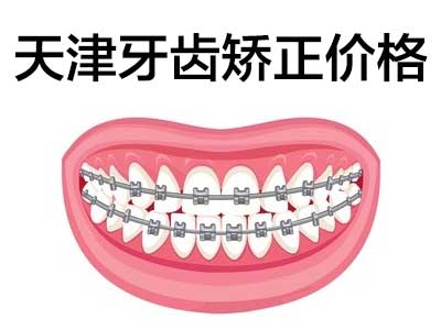 牙齿矫正价格 天津牙齿隐形矫正要多少钱