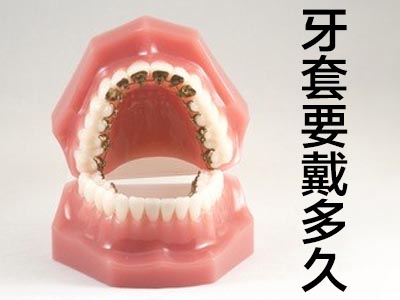 天津成人畸形牙齿矫正要多久