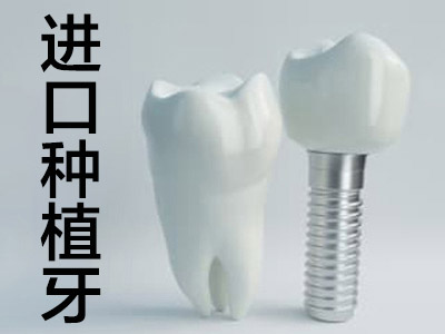 种植牙价格 天津做一颗种植牙得多少钱