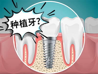 天津做种植牙大概要多少钱一颗-种植天津牙齿多少钱一个