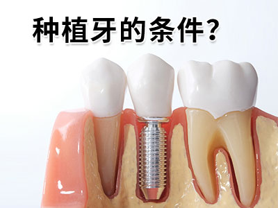 天津半口半固定种植牙二期手术-天津种植牙二期手术过程