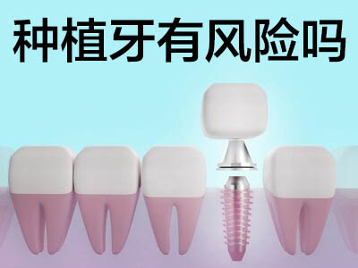 种植牙价目表 天津做种植牙手术要多少钱一颗