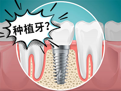 天津即刻全口种植牙一般多少钱-种植牙即刻种植费用天津