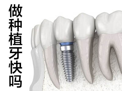 天津人工种植牙二期手术费用多少