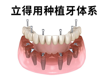 天津全口种植牙价格-天津老人种植全口牙需要多少钱