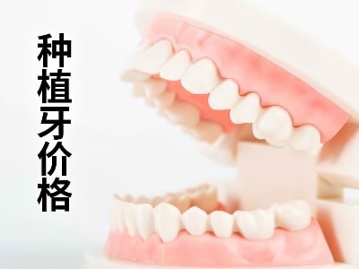 天津门牙种植牙的价格-天津门牙种植牙多少钱一颗