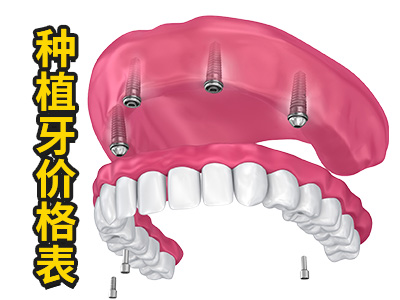 天津满口种植牙一般要多少钱?种植满口种植牙天津价格表