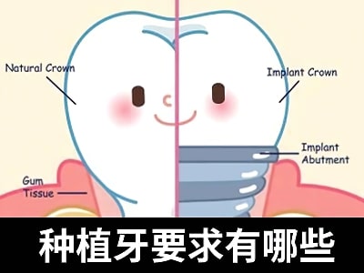 天津口腔全口种植牙的价格是多少钱