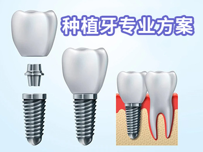 详细的天津一般做种植牙费用是多少